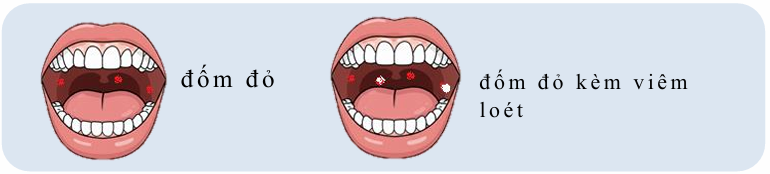 428080aba287f0eba8340e75624cdca1.png