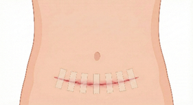 618d123e9388d5f410b3ca73cc60a21c.png