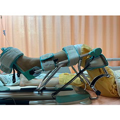 人工膝關節置換術(Total knee replacement patient information